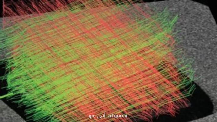 اولین فانتوم مغز سه بعدی با وضوح بالا چاپ شد
